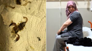 odun-tasirken-akrep-soktu-fenalasti-53-yasindaki-kadin-hastanelik-oldu-jpntuJ4l