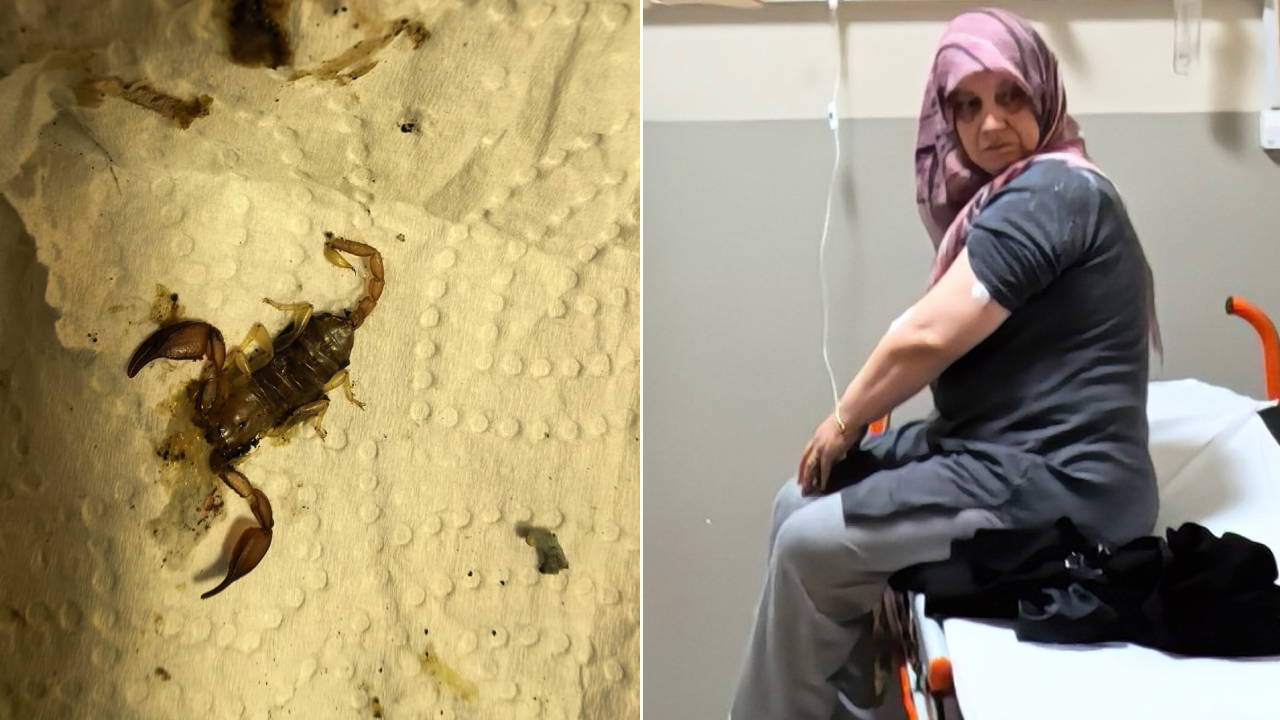 Akrep Sokması Sonucu Hastaneye Kaldırılan 53 Yaşındaki Kadının Durumu İyi