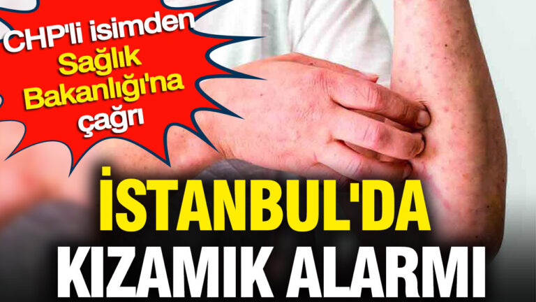 istanbulda-kizamik-alarmi-chpli-isimden-saglik-bakanligina-cagri-IdP2NmOx-1