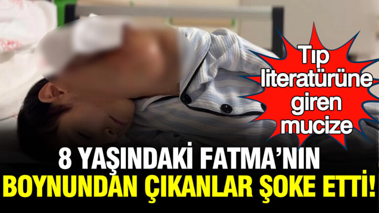mucize-cocuk-tip-literaturune-girdi-boynundan-cikanlar-soke-etti-YggvEch5